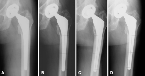 Fig. 2A–D