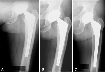 Fig. 4A–C