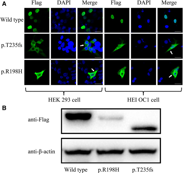 FIGURE 4