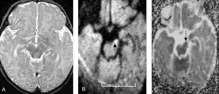 Fig 3.