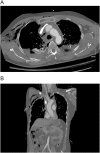 Fig. 2