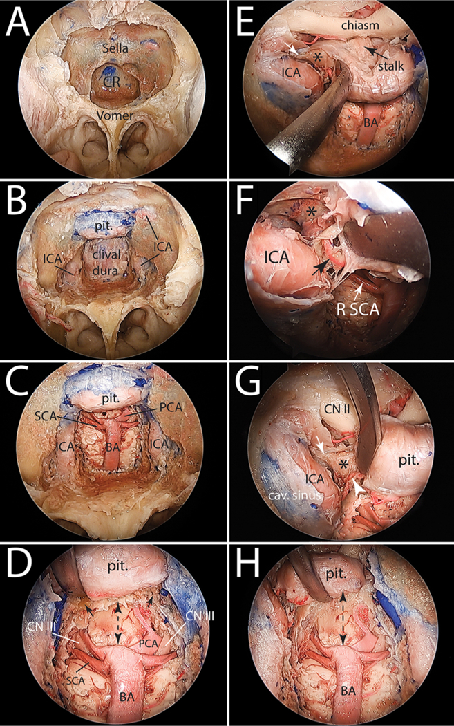 FIG. 2.