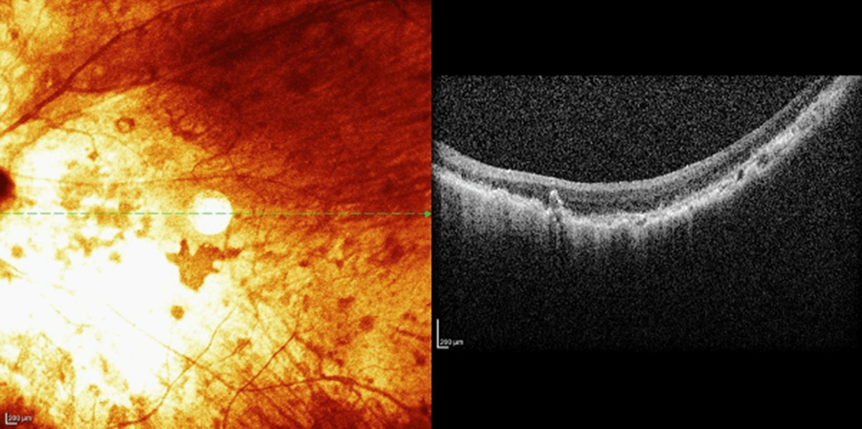 Fig. 4