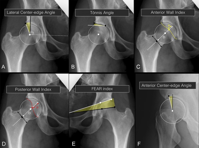 Fig. 1 A-F