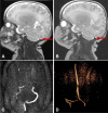 Fig. 4