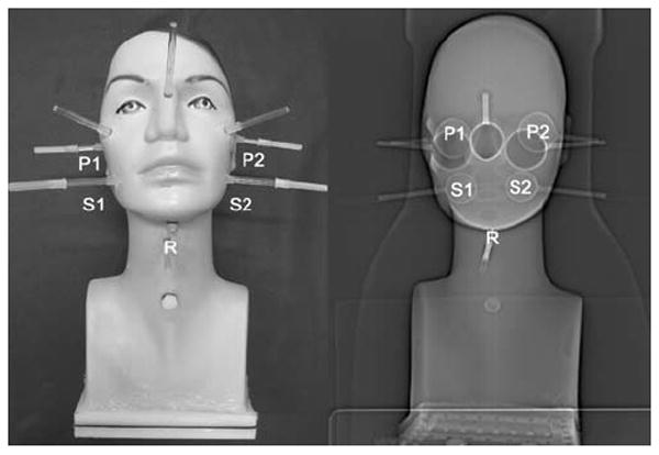 Fig. 1