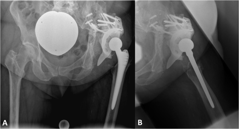 Fig. 1