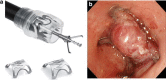 Fig. 2