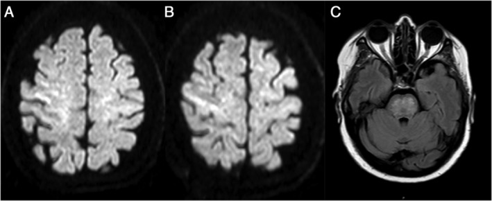 FIG. 1