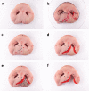 Fig. 3