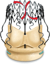 Figure 1: