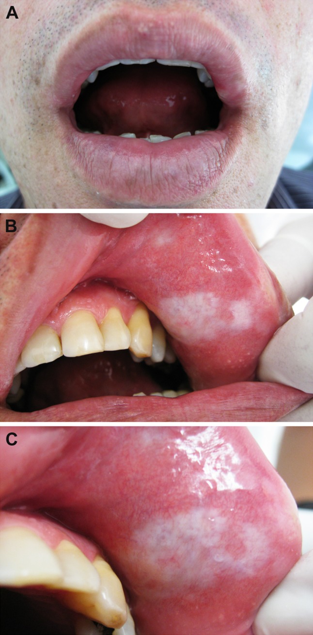 Fig. 1