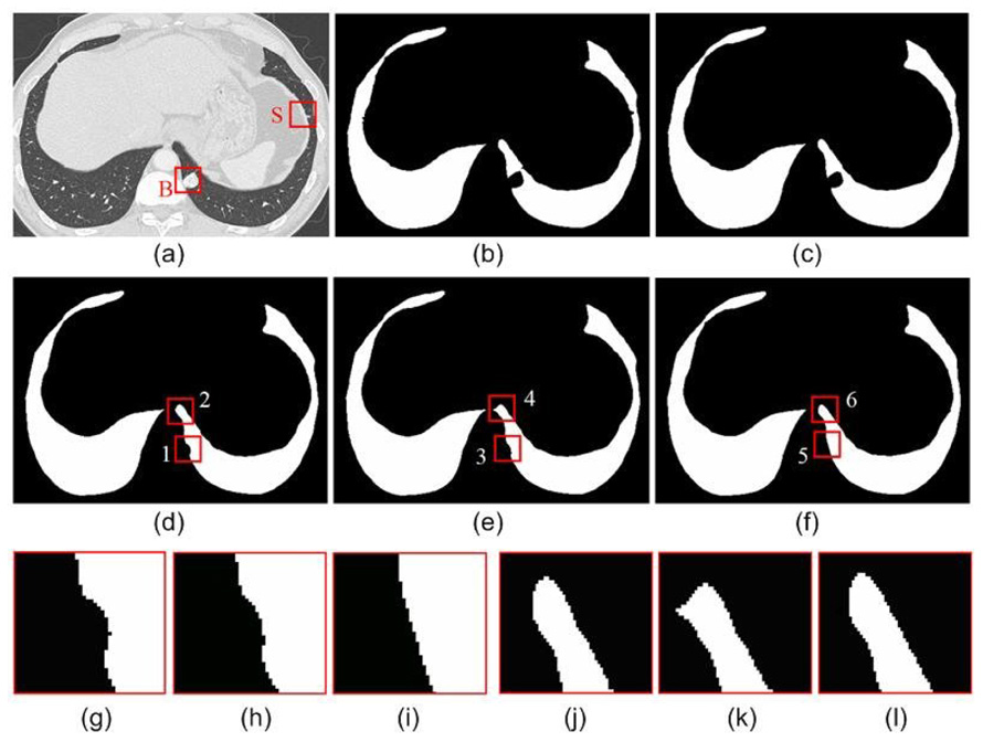 Fig. 12