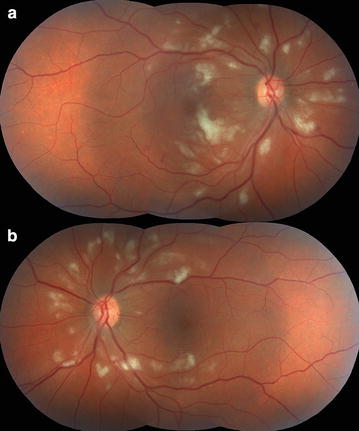 Fig. 1