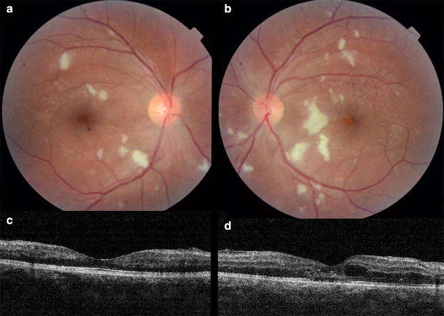 Fig. 3