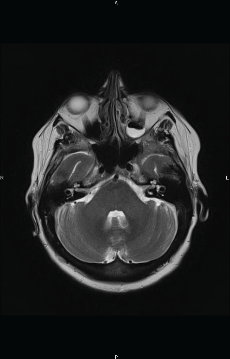 Figure 1 B.