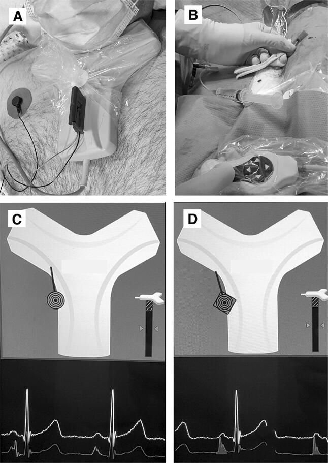 Fig. 1