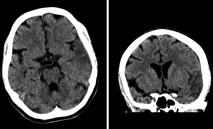 Fig. 1