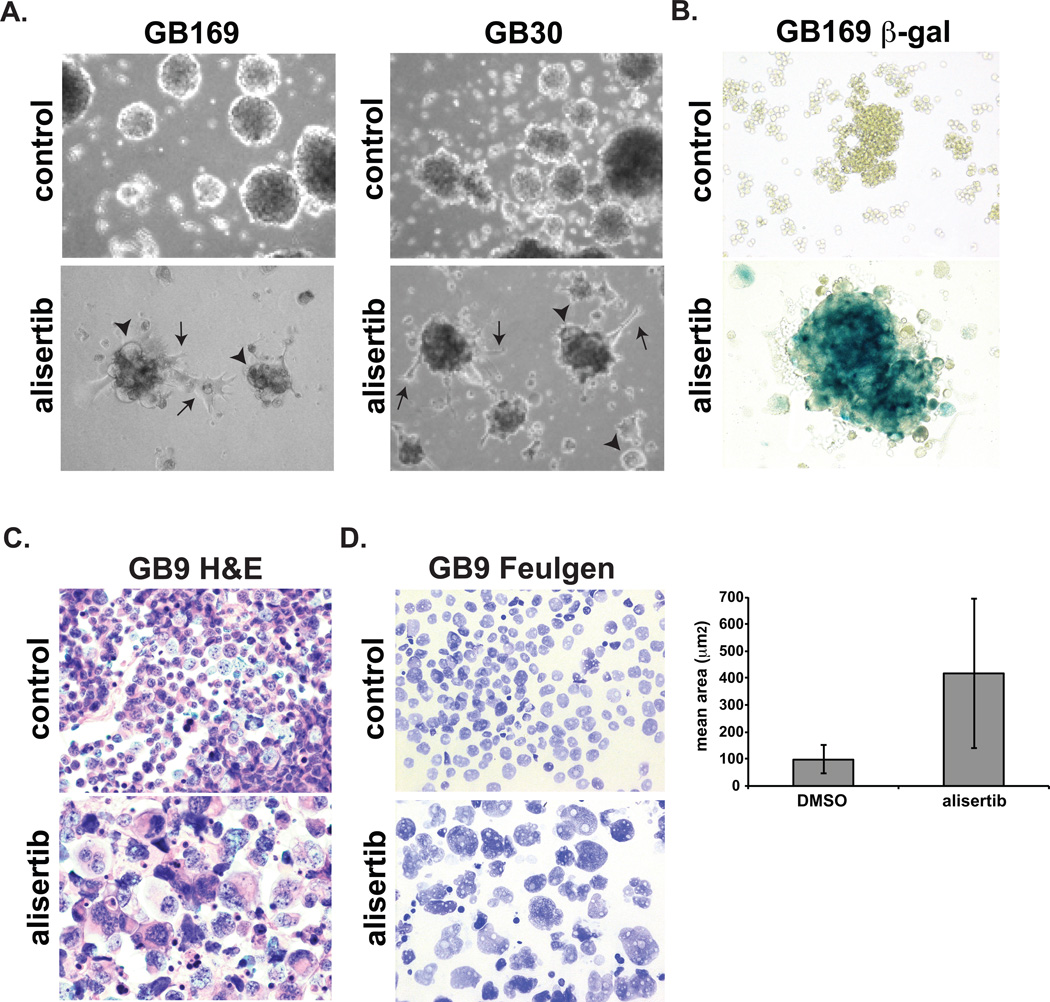 Aurora A Inhibition Offers A Novel Therapy Effective Against Intracranial Glioblastoma PMC