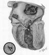 41