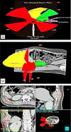 Fig.3