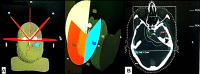 Fig.2