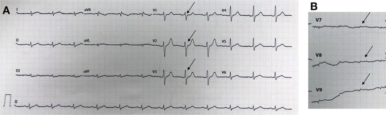 Fig. 11