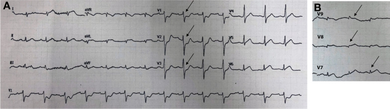 Fig. 10