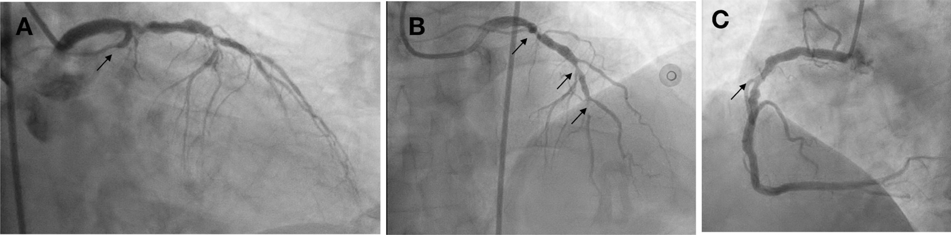 Fig. 12