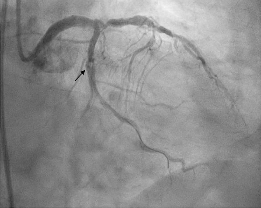 Fig. 13