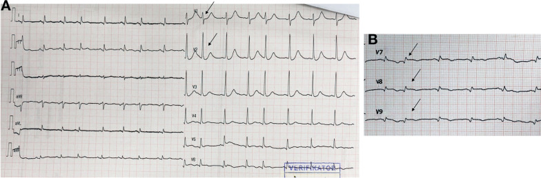 Fig. 7