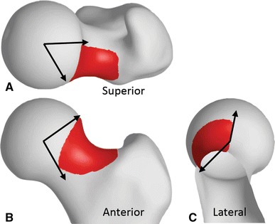 Fig. 4A–C