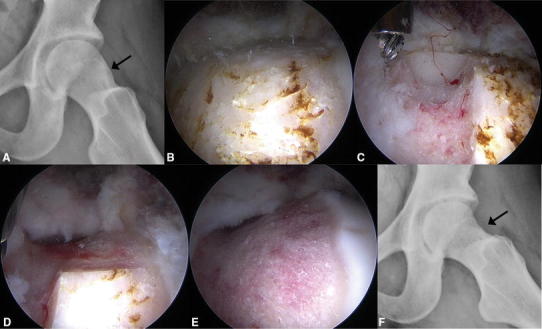 Fig. 1A–F