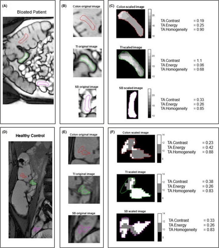 FIGURE 2