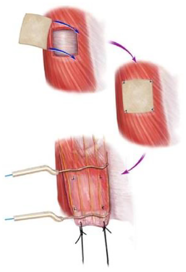 Figure 3.