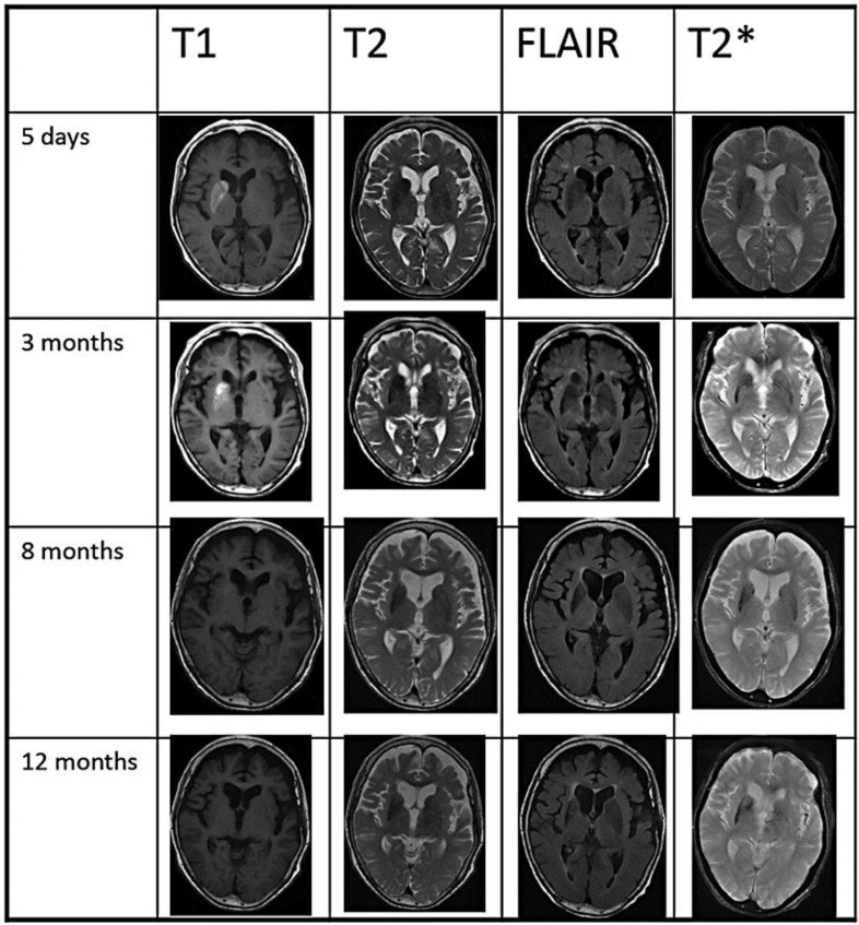 Fig. 1