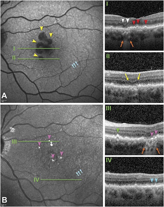 Fig. 3.