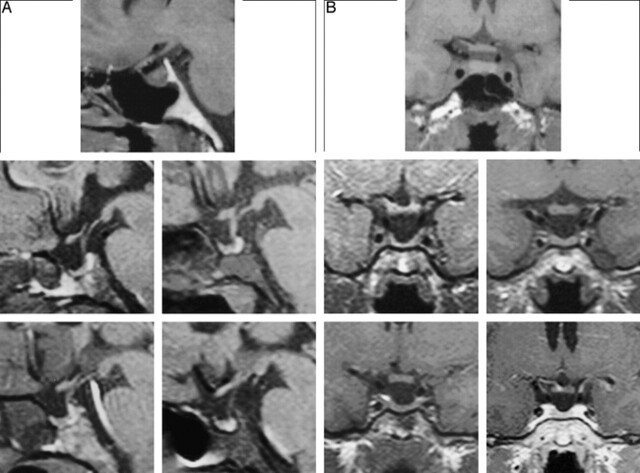 fig 2.