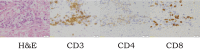 Fig. 1B