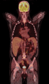 Fig 1.