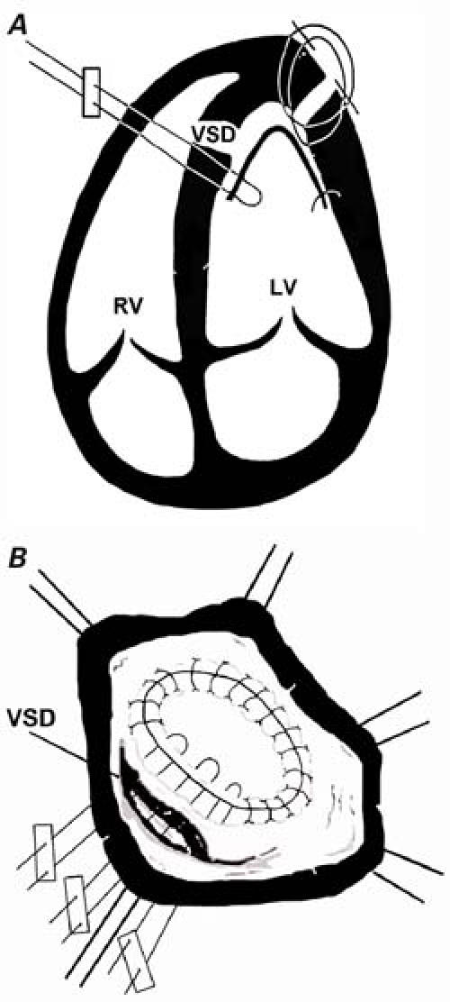 graphic file with name 11FF2.jpg