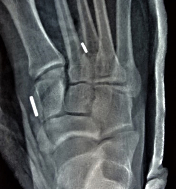 Figure 4.