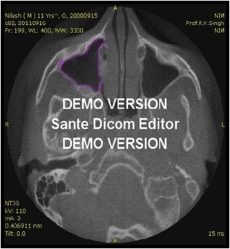 Fig. 2