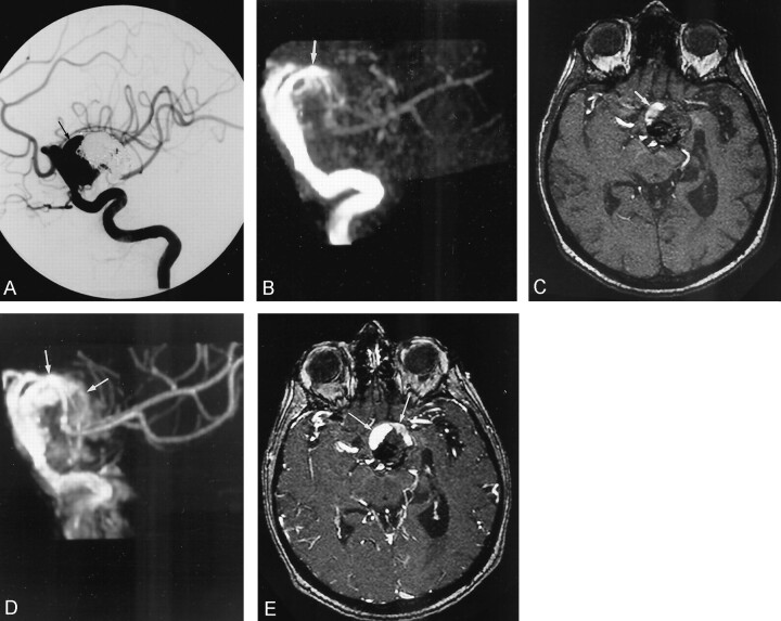 Fig 3.