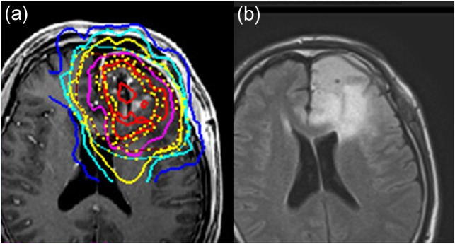 Fig. 2.