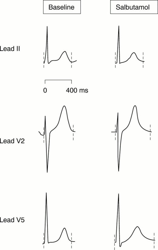 Figure 3  