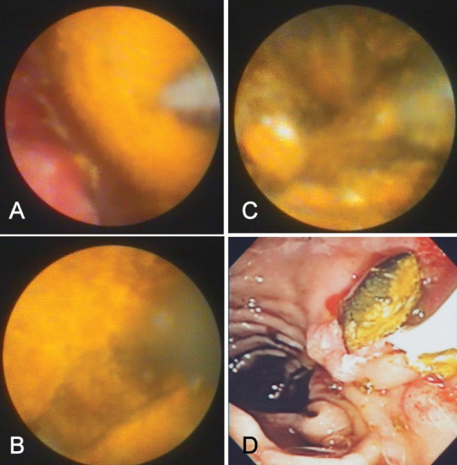 Figure 4)