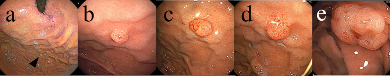 Fig. 1