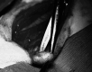 Fig 1.
