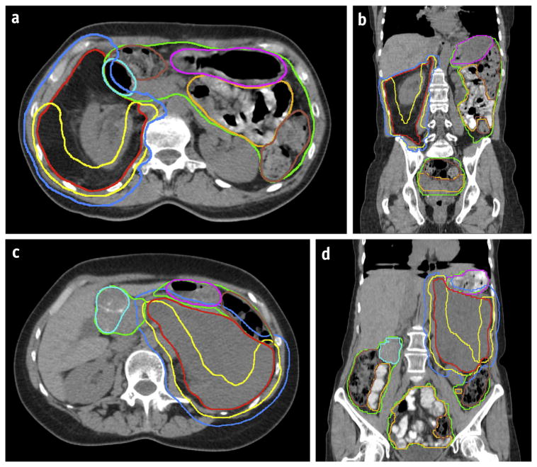 Fig. 2